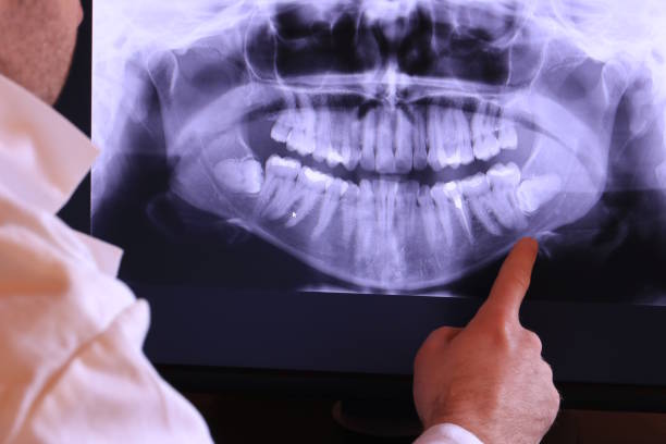 Best Emergency Treatment for Toothache in Heber Overgaard, AZ