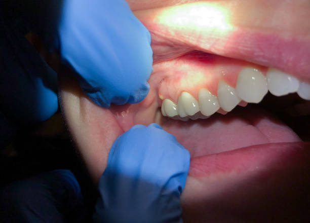 Best Emergency Treatment for Toothache in Heber Overgaard, AZ